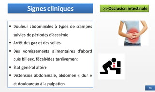 16
>> Occlusion intestinale
Définition
▪ Douleur abdominales à types de crampes
suivies de périodes d’accalmie
▪ Arrêt des gaz et des selles
▪ Des vomissements alimentaires d’abord
puis bilieux, fécaloïdes tardivement
▪ État général altéré
▪ Distension abdominale, abdomen « dur »
et douloureux à la palpation
Signes cliniques
 