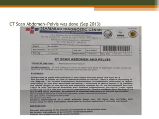 CT Scan Abdomen+Pelvis was done (Sep 2013)
 