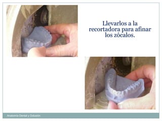 Anatomía Dental y Oclusión
Llevarlos a la
recortadora para afinar
los zócalos.
 