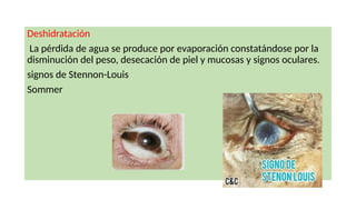 Deshidratación
La pérdida de agua se produce por evaporación constatándose por la
disminución del peso, desecación de piel y mucosas y signos oculares.
signos de Stennon-Louis
Sommer
 