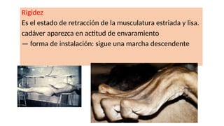 Rigidez
Es el estado de retracción de la musculatura estriada y lisa.
cadáver aparezca en actitud de envaramiento
— forma de instalación: sigue una marcha descendente
 