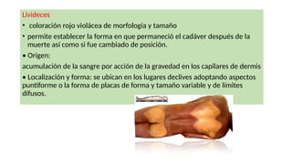 Livideces
• coloración rojo violácea de morfología y tamaño
• permite establecer la forma en que permaneció el cadáver después de la
muerte así como si fue cambiado de posición.
• Origen:
acumulación de la sangre por acción de la gravedad en los capilares de dermis
• Localización y forma: se ubican en los lugares declives adoptando aspectos
puntiforme o la forma de placas de forma y tamaño variable y de límites
difusos.
 