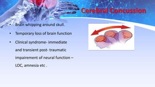 Cerebral Concussion
• Brain whipping around skull.
• Temporary loss of brain function
• Clinical syndrome- immediate
and transient post- traumatic
impairement of neural function –
LOC, amnesia etc .
 