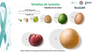 Tamaños de tumores
https://www.cancer.gov/espanol/tipos/cuello-uterino/estadios
 