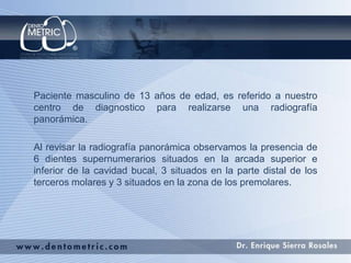 Paciente masculino de 13 años de edad, es referido a nuestro
centro de diagnostico para realizarse una radiografía
panorámica.
Al revisar la radiografía panorámica observamos la presencia de
6 dientes supernumerarios situados en la arcada superior e
inferior de la cavidad bucal, 3 situados en la parte distal de los
terceros molares y 3 situados en la zona de los premolares.
 
