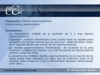 Diagnostico: Dientes supernumerarios
(distomolares y paramolares)
Comentarios:
La hiperodoncia múltiple es la aparición de 3 o mas dientes
supernumerarios.
Distomolar o tambien denominado como cuarto molar es aquella pieza
adicional a la formula normal que se ubica por distal del tercer molar,
es el segundo diente mas común de los supernumerarios.
Los dientes supernumerarios Paramolares Se localizan en la cara
vestibular o palatina de molares. Los mas frecuentes se ubican entre el
primero y segundo molar.
La presencia de múltiples dientes supernumerarios en la mayoría de los
casos puede estar asociada con algún tipo de síndrome, como el de
Gardner, fabry Anderson y con la denominada displasia cleidocraneal,
entre otros.
 