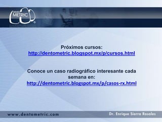 Próximos cursos:
http://dentometric.blogspot.mx/p/cursos.html
Conoce un caso radiográfico interesante cada
semana en:
http://dentometric.blogspot.mx/p/casos-rx.html
 