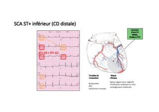 Diaporama DPC Urgences SFMU SCA ST+ 2019