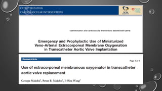 ECMO