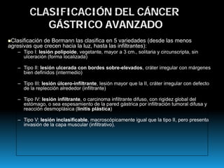 CLASIFICACIÓN DEL CÁNCER
GÁSTRICO AVANZADO
Clasificación de Bormann las clasifica en 5 variedades (desde las menos
agresivas que crecen hacia la luz, hasta las infiltrantes):
– Tipo I: lesión polipoide, vegetante, mayor a 3 cm., solitaria y circunscripta, sin
ulceración (forma localizada)
– Tipo II: lesión ulcerada con bordes sobre-elevados, cráter irregular con márgenes
bien definidos (intermedio)
– Tipo III: lesión úlcero-infiltrante, lesión mayor que la II, cráter irregular con defecto
de la replección alrededor (infiltrante)
– Tipo IV: lesión infiltrante, o carcinoma infiltrante difuso, con rigidez global del
estómago, o sea espesamiento de la pared gástrica por infiltración tumoral difusa y
reacción desmoplásica (linitis plástica)
– Tipo V: lesión inclasificable, macroscópicamente igual que la tipo II, pero presenta
invasión de la capa muscular (infiltrativo).
 