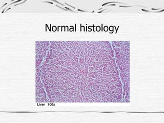 Normal histology
 