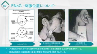 02
• 戸島先生の論文や一部の海外の文献では耳の前に陽極を配置する方法が記載されている。
• 関西の施設からは耳後部に陽極を配置する方法が多く報告されている。
ENoG -刺激位置について-
右口輪筋に至る頸枝を刺激
(JOHNS:7:11:164, 1991)
NET刺激方法
(JOHNS:16:3:336, 2000)
AudiologyOnline
 