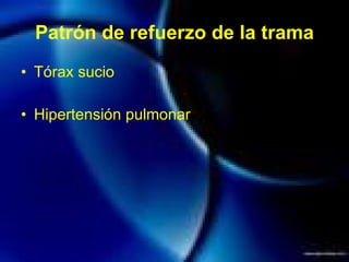 Patrón de refuerzo de la trama Tórax sucio Hipertensión pulmonar 