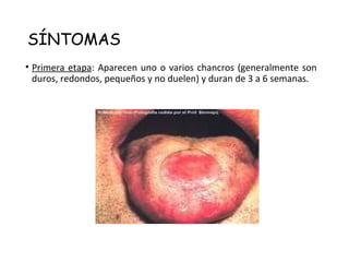 SÍNTOMAS
• Primera etapa: Aparecen uno o varios chancros (generalmente son
duros, redondos, pequeños y no duelen) y duran de 3 a 6 semanas.
 