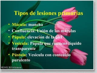 Tipos de lesiones primarias Mácula : mancha  Confluencia: Unión de las máculas Pápula : elevación de la piel Vesícula : Pápula que contiene líquido transparente Pústula : Vesícula con contenido purulento 