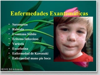 Enfermedades Exantemáticas  Sarampión Rubéola Exantema Súbito Eritema Infeccioso Varicela Escarlatina  Enfermedad de Kawasaki Enfermedad mano pie boca 