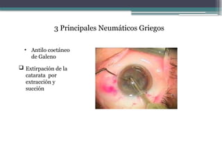 • Antilo coetáneo
de Galeno
3 Principales Neumáticos Griegos
 Extirpación de la
catarata por
extracción y
succión
 
