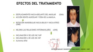 EFECTOS DEL TRATAMIENTO
u DESPLAZAMIENTO HACIA ADELANTE DEL MAXILAR (SNA)
u ACCIÓN DENTO-ALVEOLAR Y ÓSEA DE LA MAXILA.
u ROTACIÓN MANDIBULAR HACIA ABAJO Y HACIA ATRÁS
(SNB)
u MEJORA LAS RELACIONES INTERMAXILARES (ANB)
u INCLINACIÓN V DE LOS INC SUP
u INCLINACIÓN L DE LOS INC INF
u Aumenta AFAI
ORTOPEDIA MAXILAR Y DIAGNOSTICO TOMAS RAKOSY , EDICION 1 -2007
 