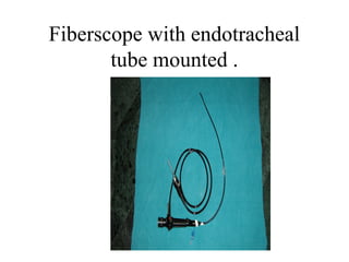 Fiberscope with endotracheal
tube mounted .
 