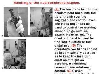 (A) The handle is held in the
nondominant hand with the
tip of thumb over the
sagittal plane control lever.
The index finger can be
used to control the working
channel (e.g., suction,
oxygen insufflation). The
dominant hand is used for
fine manipulation at the
distal end. (B) The
operator's two hands should
be kept maximally apart so
as to keep the insertion
shaft as straight as
possible, maximizing
coronal plane rotational
control. (C) Curves
48
Handling of the fiberopticbronchoscope.
 