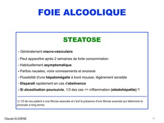 FOIE ALCOOLIQUE
STEATOSE
- Généralement macro-vésiculaire 
- Peut apparaître après 2 semaines de forte consommation 
- Habituellement asymptomatique 
- Parfois nausées, voire vomissements et anorexie 
- Possibilité d'une hépatomégalie à bord mousse, légèrement sensible
- Disparaît rapidement en cas d'abstinence 
- Si alcoolisation poursuivie, 1/3 des cas => infllammation (stéatohépatite) 1)
.............................................................................................................................................
1) 1/3 de ces patient a une fibrose associée et c'est la présence d'une fibrose avancée qui détermine le
pronostic à long terme.
Claude EUGÈNE 11
 