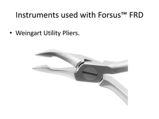 Instruments used with Forsus™ FRD
• Weingart Utility Pliers.
 