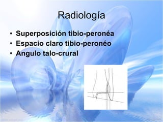 Radiología Superposición tibio-peronéa   Espacio claro tibio-peronéo   Angulo talo-crural   