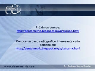 Próximos cursos: 
http://dentometric.blogspot.mx/p/cursos.html 
Conoce un caso radiográfico interesante cada 
semana en: 
http://dentometric.blogspot.mx/p/casos-rx.html 
