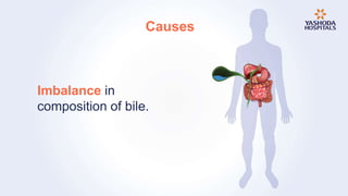 Causes
Imbalance in
composition of bile.
 