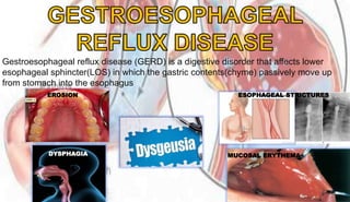 Gestroesophageal reflux disease (GERD) is a digestive disorder that affects lower
esophageal sphincter(LOS) in which the gastric contents(chyme) passively move up
from stomach into the esophagus
EROSION ESOPHAGEAL STRICTURES
MUCOSAL ERYTHEMADYSPHAGIA
 