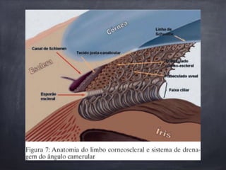 Glaucoma