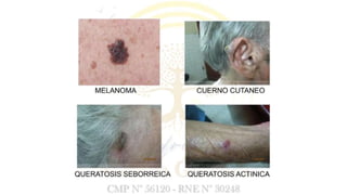 ENVEJECIMIENTO DE APARATOS Y SISTEMAS DEL CUERPO HUMANO