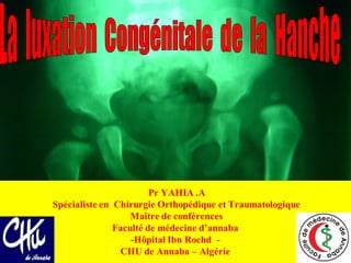La luxation congénitale de la hanche