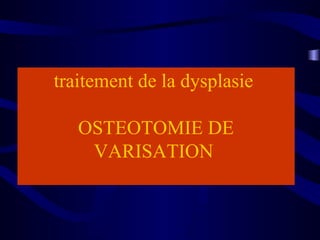 traitement de la dysplasie
OSTEOTOMIE DE
VARISATION
 