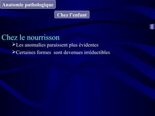 Anatomie pathologique
Chez l’enfant
Chez le nourrisson
Les anomalies paraissent plus évidentes
Certaines formes sont devenues irréductibles
 