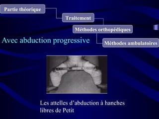 Partie théorique
Traitement
Méthodes orthopédiques
Méthodes ambulatoiresAvec abduction progressive
Les attelles d’abduction à hanches
libres de Petit
 