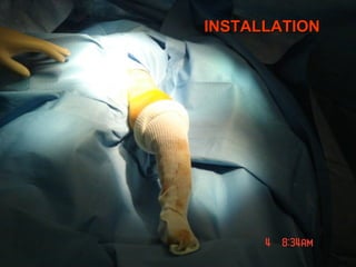 INSTALLATIONINSTALLATION
 