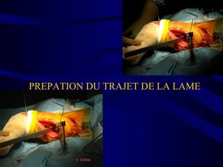 PREPATION DU TRAJET DE LA LAME
 