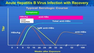 32
Acute Hepatitis B Virus Infection with Recovery
 