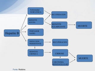 Hepatite B
Enfermedad
SUBCLÍNICA
HEPATITE
AGUDA
PORTADOR
SADIO
INFECCION
PERSISTENTE
HEPATITE
CRÔNICA
RECUPERACION
HEPATITE
FULMINANTE MUERTE
MUERTE
RECUPERACION
CIRROSE
CARCINOMA
HEPATOCELULAR
Fonte: Robbins
 