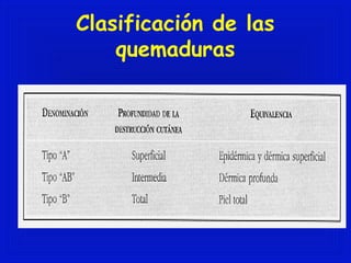 Clasificación de las 
quemaduras 
 