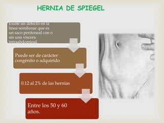 HERNIA DE SPIEGEL
Existe un defecto en la
línea semilunar que es
un saco peritoneal con o
sin una víscera
intraabdominal.
Puede ser de carácter
congénito o adquirido
0.12 al 2% de las hernias
Entre los 50 y 60
años.
 