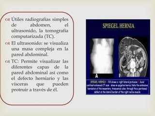  Útiles radiografías simples
de abdomen, el
ultrasonido, la tomografía
computarizada (TC).
 El ultrasonido: se visualiza
una masa compleja en la
pared abdominal.
 TC: Permite visualizar las
diferentes capas de la
pared abdominal así como
el defecto herniario y las
vísceras que pueden
protruir a través de él.
 