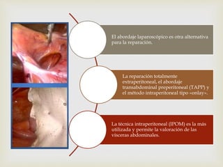 El abordaje laparoscópico es otra alternativa
para la reparación.
La reparación totalmente
extraperitoneal, el abordaje
transabdominal preperitoneal (TAPP) y
el método intraperitoneal tipo «onlay».
La técnica intraperitoneal (IPOM) es la más
utilizada y permite la valoración de las
vísceras abdominales.
 