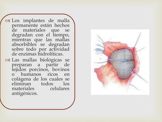  Los implantes de malla
permanente están hechos
de materiales que se
degradan con el tiempo,
mientras que las mallas
absorbibles se degradan
sobre todo por actividad
de enzimas hidrolíticas.
 Las mallas biológicas se
preparan a partir de
tejidos porcinos, bovinos
o humanos ricos en
colágena de los cuales se
eliminan todos los
materiales celulares
antigénicos.
 