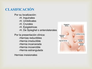 CLASIFICACIÓN
Por su localización:
-H. Inguinales
-H. Umbilicales
-H. Crurales
-H. Epigástricas
-H. De Spieghel o anterolaterales
Por la presentación clínica:
-Hernias reductibles
-Hernia irreductible
-Hernia incarcerada
-Hernia incoercible
-Hernia estrangulada
Hernias insisionales
 