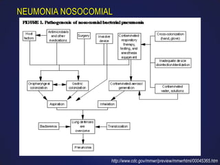 NEUMONIA NOSOCOMIAL




                  http://www.cdc.gov/mmwr/preview/mmwrhtml/00045365.htm
 