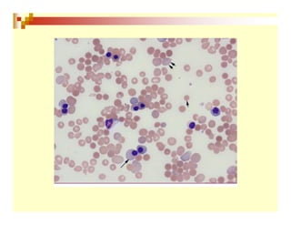 Inmunohematología final