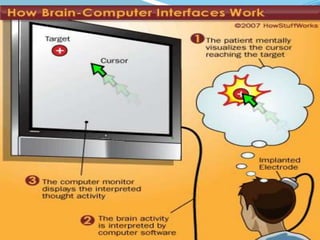 BRAIN COMPUTER INTERFACE