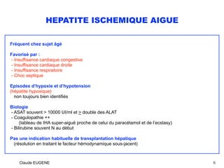 HEPATITE ISCHEMIQUE AIGUE
Fréquent chez sujet âgé
Favorisé par :
- Insuffisance cardiaque congestive
- Insuffisance cardiaque droite
- Insuffisance respiratoire 
- Choc septique
Episodes d’hypoxie et d’hypotension 
(hépatite hypoxique) 
non toujours bien identifiés
Biologie
- ASAT souvent > 10000 UI/ml et > double des ALAT 
- Coagulopathie ++ 
(tableau de IHA super-aiguë proche de celui du paracétamol et de l’ecstasy) 
- Bilirubine souvent N au début
Pas une indication habituelle de transplantation hépatique 
(résolution en traitant le facteur hémodynamique sous-jacent) 
Claude EUGENE 6
 